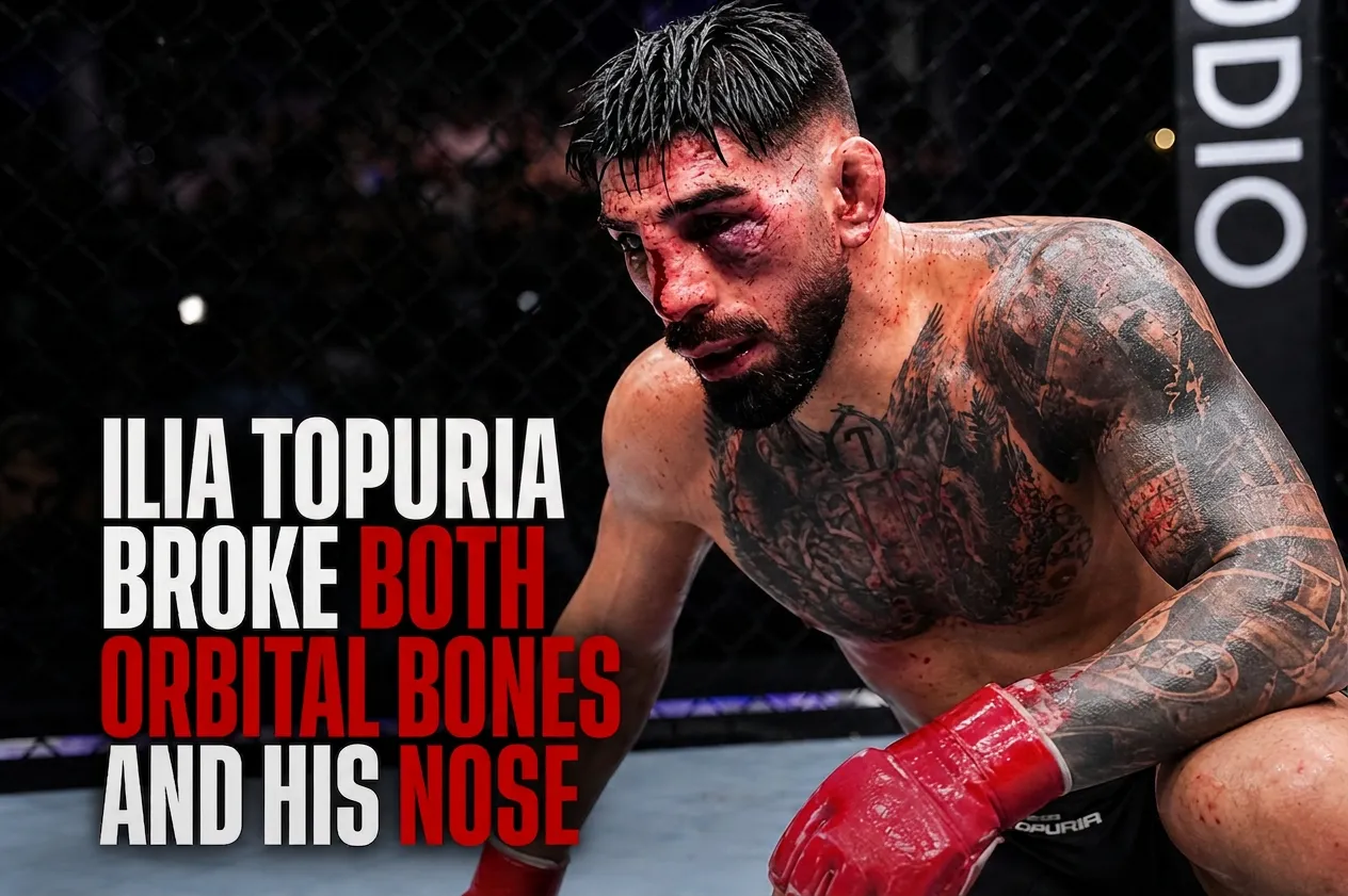 Ilia Topuria orbital fractures both eyes UFC Freedom 250 White House injury update no return 2026 June 17